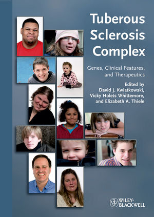 Tuberous Sclerosis Complex: Genes, Clinical Features and Therapeutics David J. Kwiatkowski, Elizabeth A. Thiele, Vicky Holets Whittemore