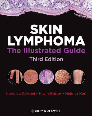 skin lymphoma